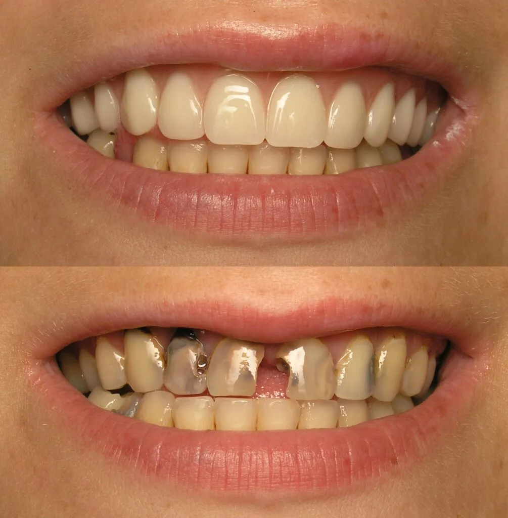 Dental Anxiety and Oral Health sedation_dentistry_results