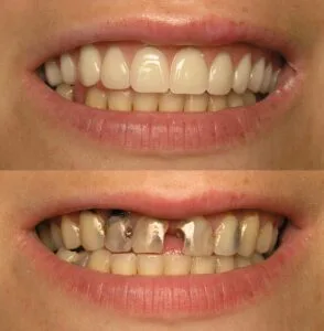 Sedation Dentistry Results 294x300